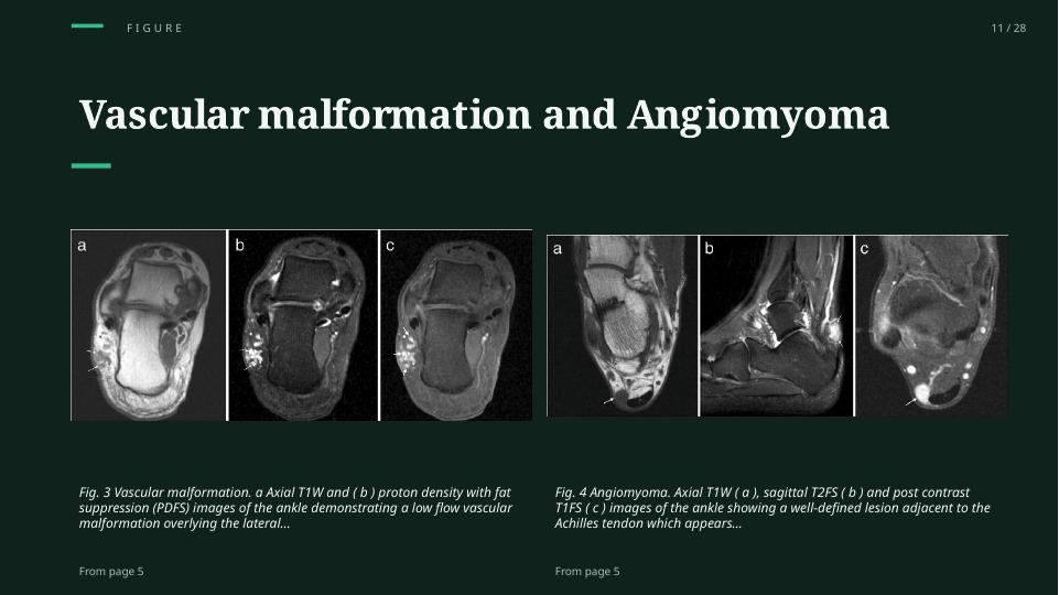 MRI of Soft Tissue Tumors of the Foot and Ankle: Multi-image plate preserved
